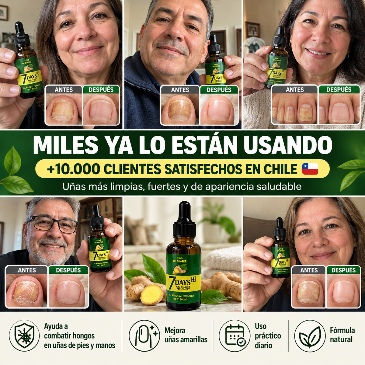 Tratamiento Anti Hongos - Elimina Uñas Amarillas y las Fortalece desde 7 Días