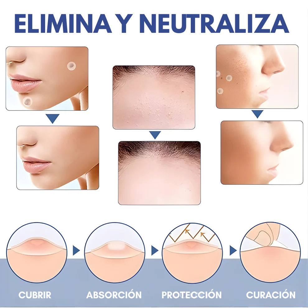 DermaClear™ - 144 Parches Eliminador de Verrugas y Lunares