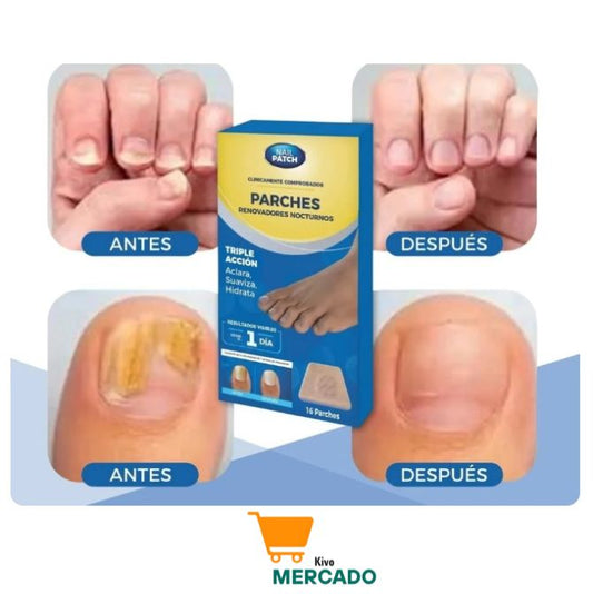 3 x 1 Parches para uñas - Elimina Hongos sin esfuerzo (48 parches en total)