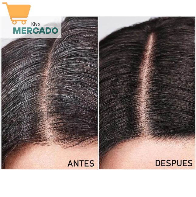 Shampoo Cubre Canas Dexe - Te hará lucir más joven + ENVÍO GRATIS 🧤🪮👩👨