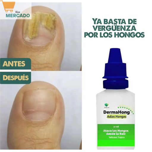DERMAHONG Anti-Hongos 3X1 ELIMINA HONGOS, Picazón y Mal Olor