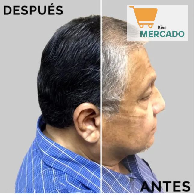 Shampoo Cubre Canas Dexe - Te hará lucir más joven + ENVÍO GRATIS 🧤🪮👩👨
