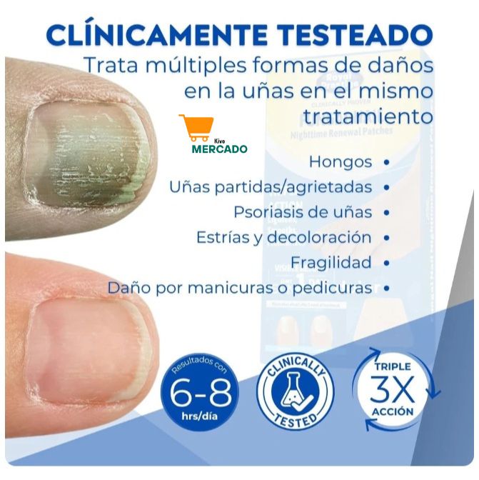 3 x 1 Parches para uñas - Elimina Hongos sin esfuerzo (48 parches en total)