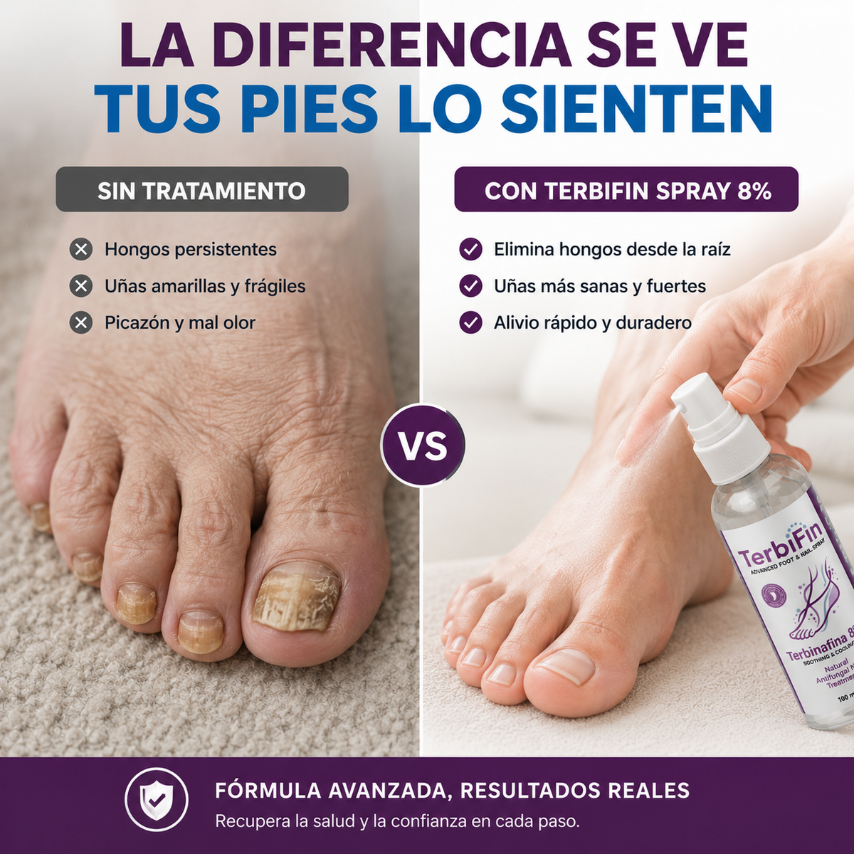TerbiFin Spray 8% Anti-Hongos Pies y Uñas