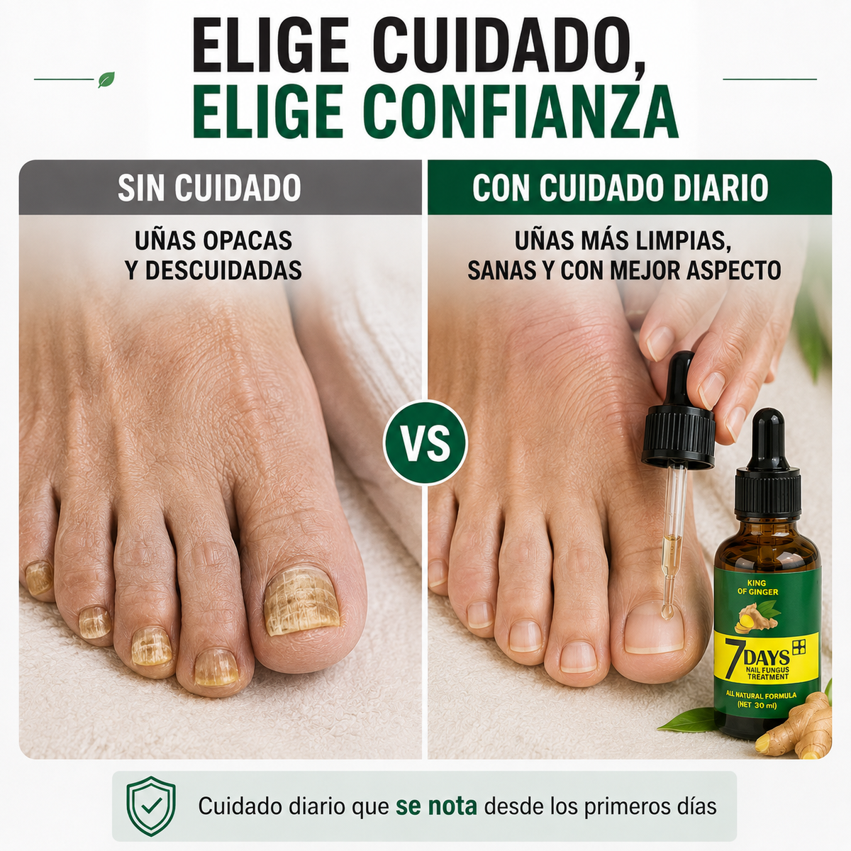 TRATAMIENTO ANTI HONGOS 100% NATURAL 7 DÍAS