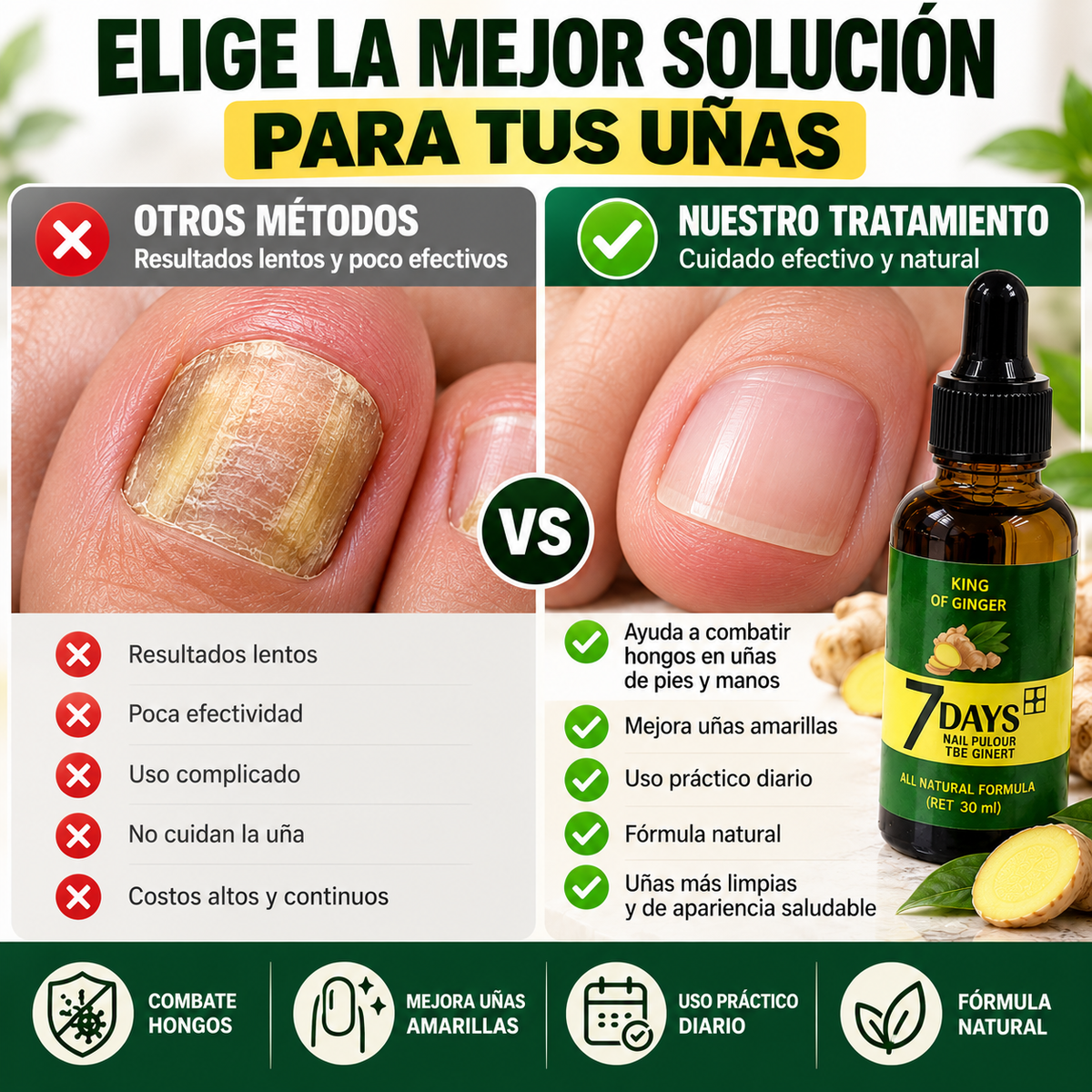 Tratamiento Anti Hongos - Elimina Uñas Amarillas y las Fortalece desde 7 Días