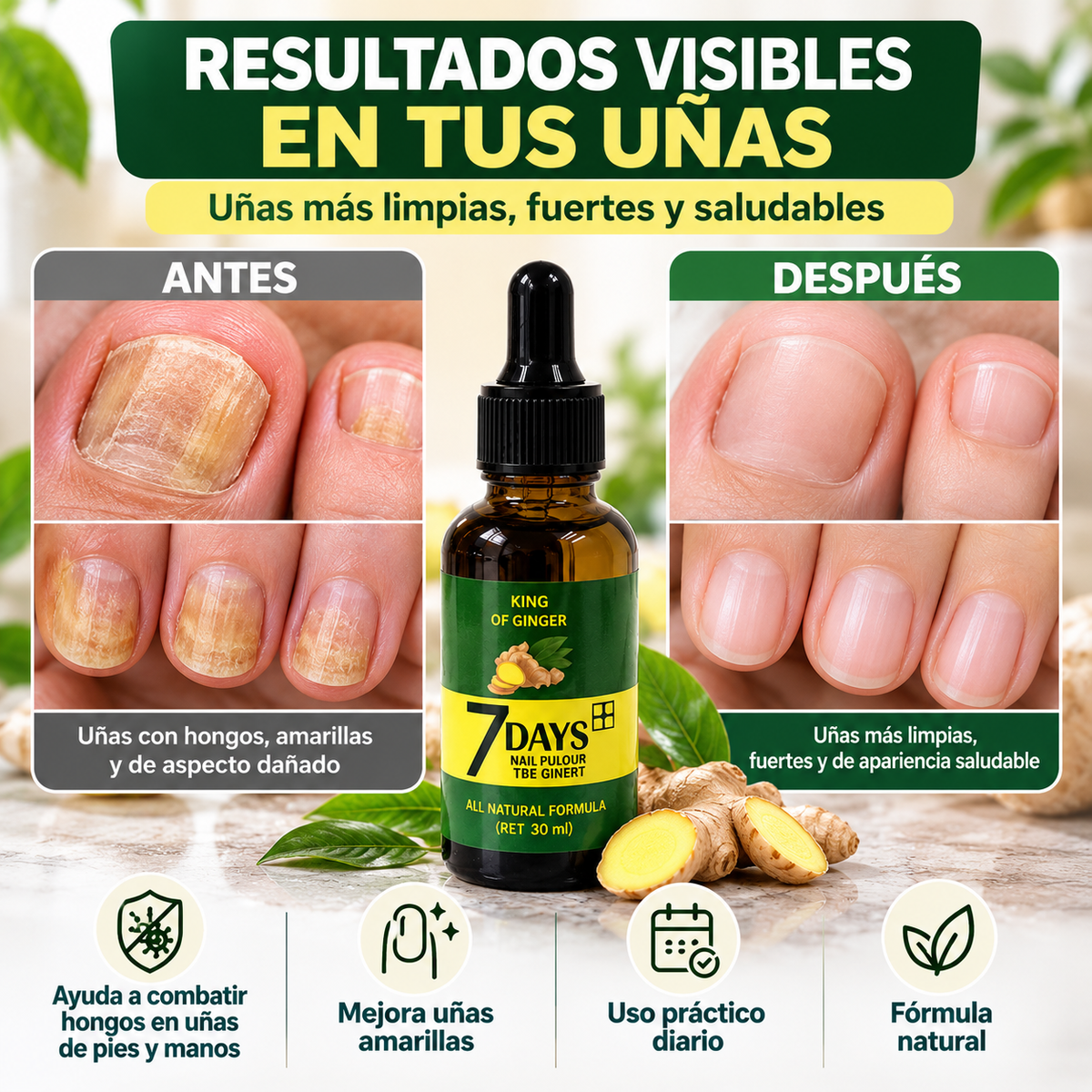 Tratamiento Anti Hongos - Elimina Uñas Amarillas y las Fortalece desde 7 Días