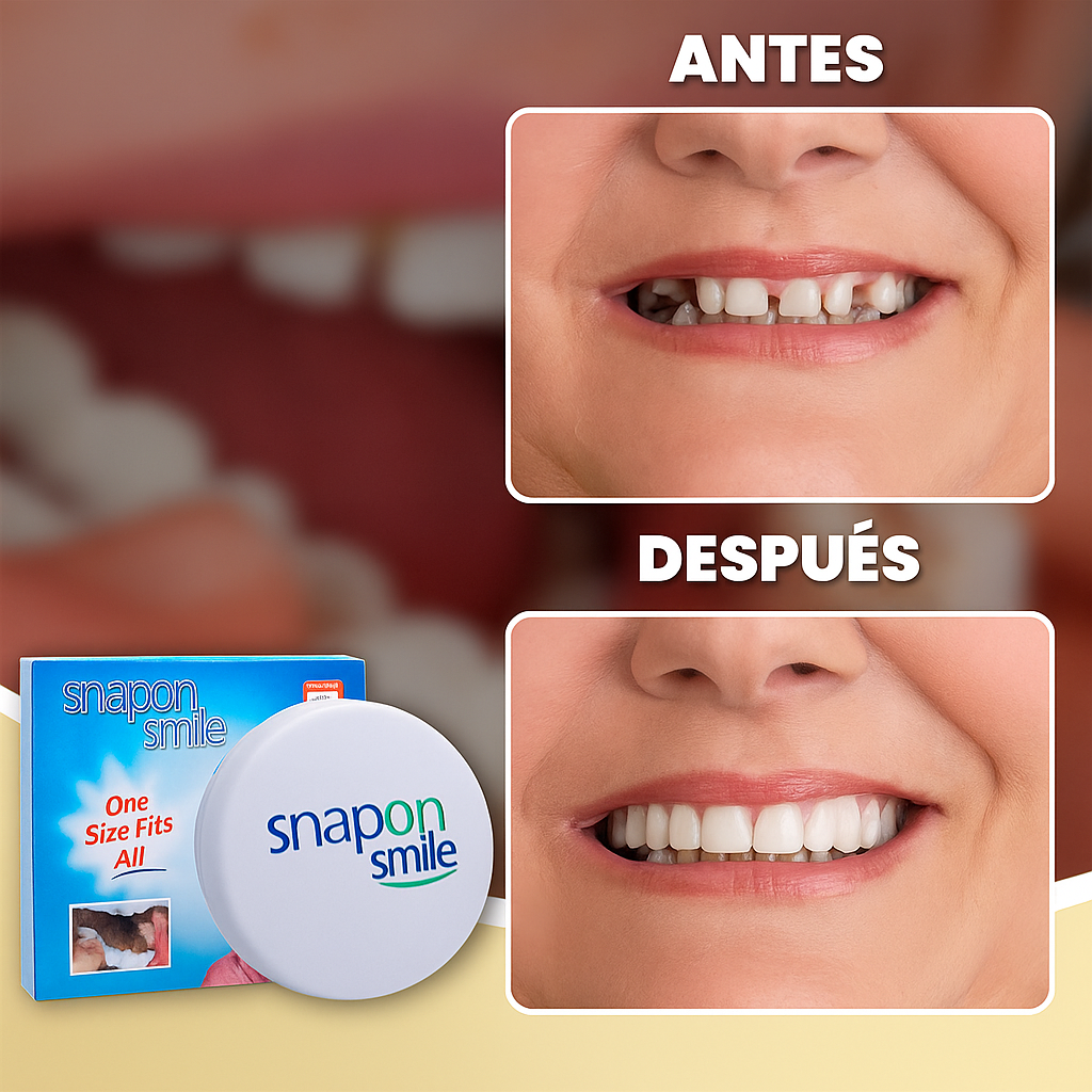 SnapOn Smile™ - Carillas Dentales🦷