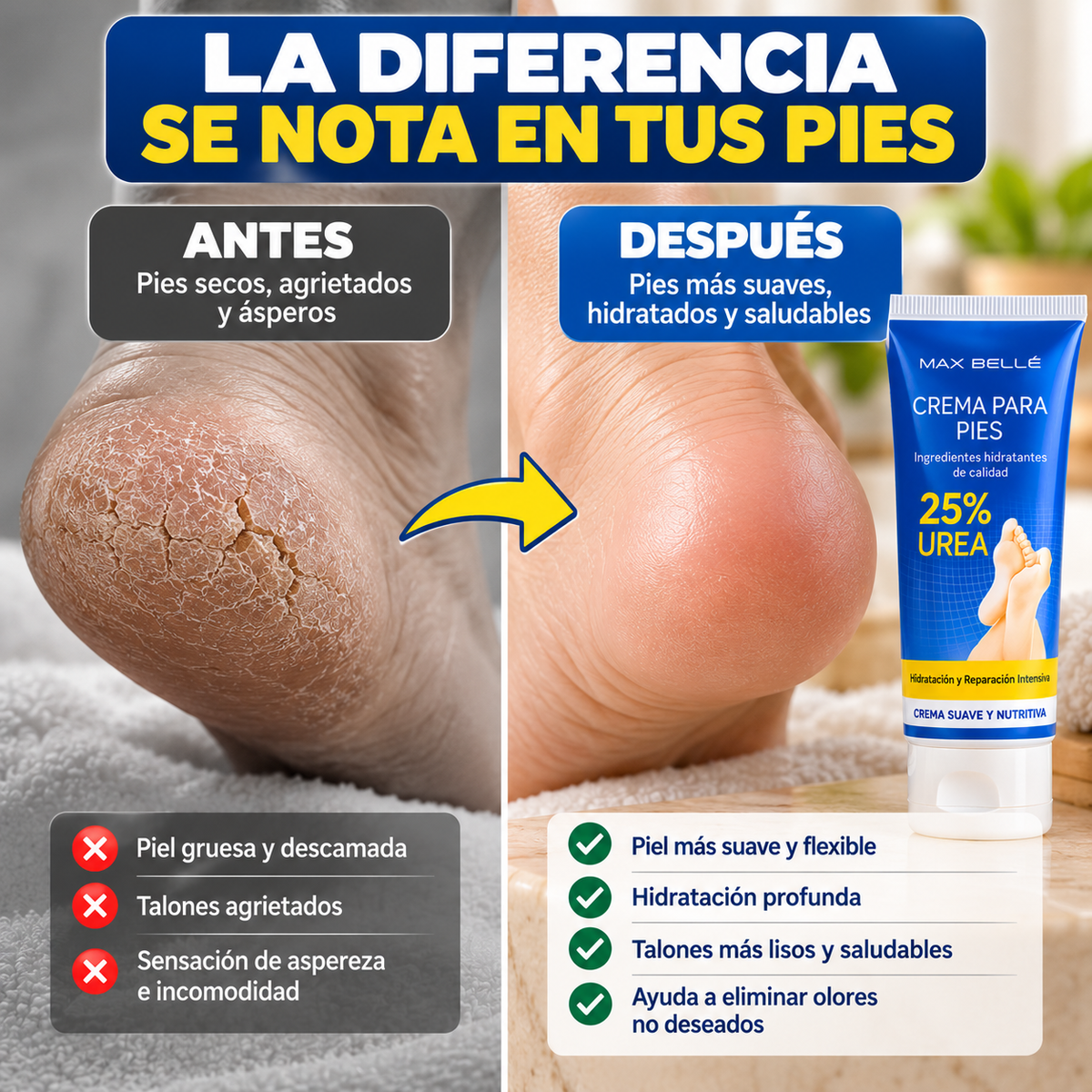 UreaRepair™ – Crema Reparadora para Pies Secos, Agrietados y Escamosos
